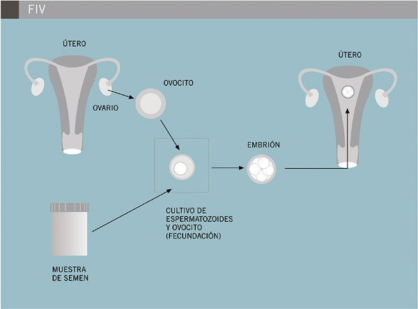 COMO SE HACE UNA FERTILIZACION IN VITRO.